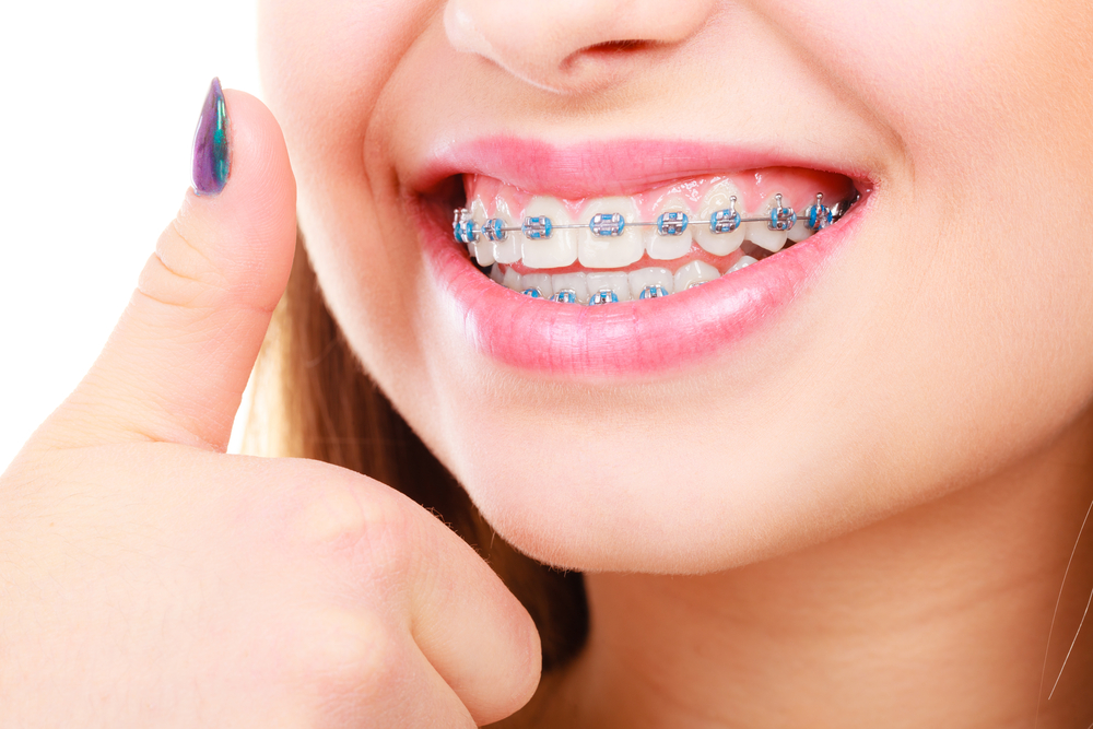 Discover the Best Orthodontist Specialist in Lahore at SmileOn